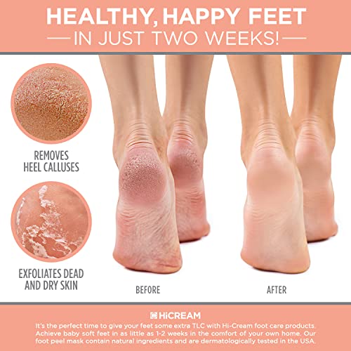 Hicream Foot Peel Mask- Pairs of Regular Skin Exfoliating Foot