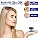 Carapex Dark Spot Corrector, for Uneven Skin Tones, Acne Scars and Marks, Gentle Treatment Cream Suitable for Face, Body and Hands, Packed with Natural Ingredients (Single)