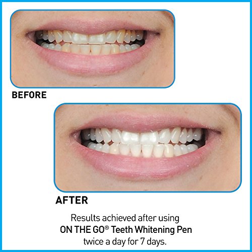 Go Smile On The Go Teeth Whitening Pen Duo, 2 Count All Dental Products