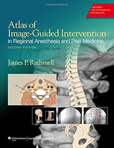 Download Atlas of Image-Guided Intervention in Regional Anesthesia and Pain Medicine PDF