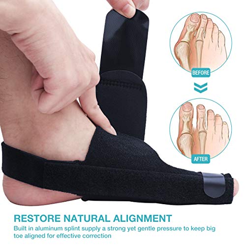 Bunion Corrector & Bunion Relief Kit, Bunion Splint Toe Separator Toe Spacer Straightener Brace for Bunion, Overlapping Toes,Hammer Toes, Hallux Valgus Pain Relief for Men & Women by MANGZ