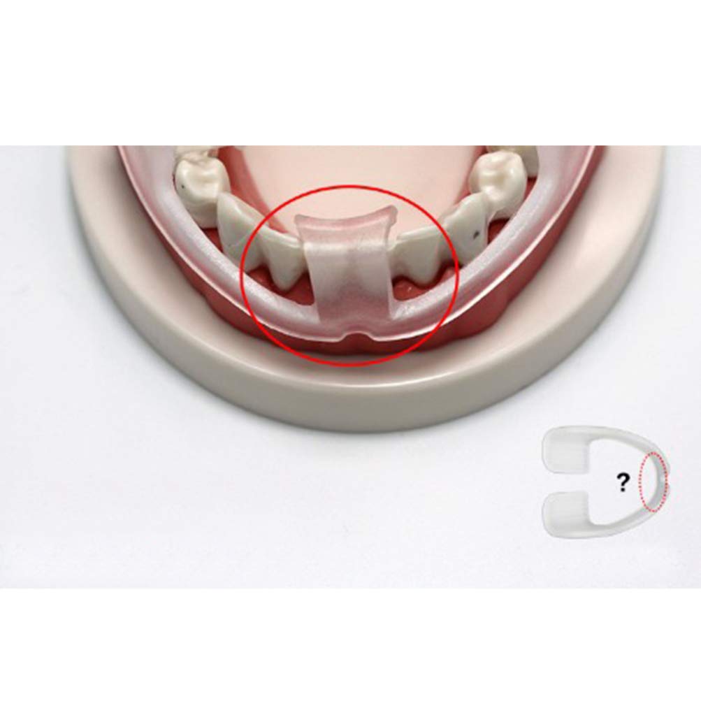 Garneck Dental Guard Sleeping Teeth Mouth Guard to Prevent Teeth Grinding Dental Protector 3pcs (Transparent) : Beauty