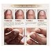 Mchoice Nail Treatment Essence Nail and Foot Whitening Toe Nail Fungus Removal