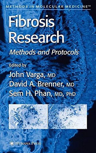 Download Fibrosis Research: Methods and Protocols (Methods in Molecular Medicine) Download Fibrosis Research: Methods and Protocols (Methods in Molecular Medicine)