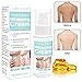 Skin Lightening Cream,Bleaching Cream,Whitening Cream,Brightening Cream,Dark Spot Corrector for Face,Hyperpigmentation,Whitens, Nourishes, Repairs & Restores Skin