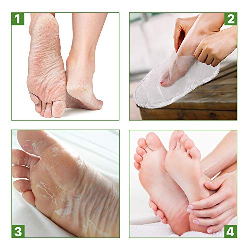 Foot Peel Mask Exfoliating (3 pairs) - Foot Peeling Mask (2 pairs) & Moisturizing Foot Mask (1 pairs), Make Your Feet Baby Soft, Peel Away Calluses and Dead Skin for Women & Men - Thumbnail 3
