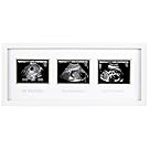 Pearhead Triple Sonogram Pregnancy Keepsake Frame, Watch Baby Grow Through all Three Trimesters - Great Gift For Expecting Parents, White