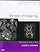 Brain Imaging: Case Review Series