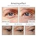 Retinol Serum, LANBENA Anti-Aging Serum with Hyaluronic Acid & Vitamin E - Minimizes Wrinkles, Fades Dark Spots - 5 Pack