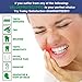 Tomiya Snore Stopper Mouthpiece - Snoring Solution, Sleep Aid Night Mouth Guard Bruxism Mouthpiece, Best anti snoring device, sleep well and quiet sleeping night