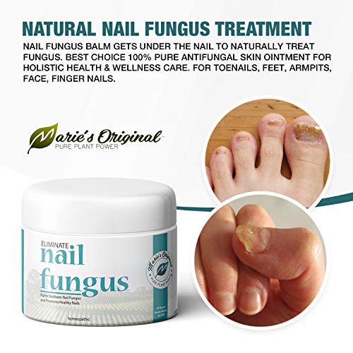 Marie's Original Nail & Toenail Fungus Cream - Natural Organic Handmade Antifungal Healing Ointment Topical Treatment - Essential Oil Herbal Remedy for Jock Itch, Ringworm, Yeast Infection