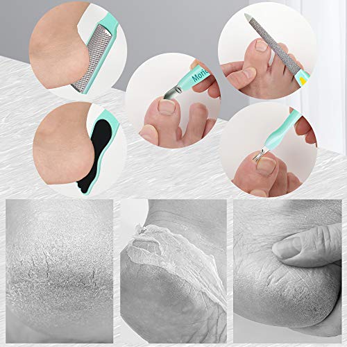 Pedicure Kit Set 6 in 1,Moricoxs Colossal Foot Rasp Foot File And Callus Remover For Feet, Stainless Steel Foot Care Tools, Foot Rasp, Feet Dead Skin Remover,Pedicure Kit For Men Women Gift