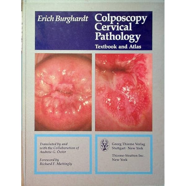 Tumors of the Salivary Glands (AFIP Atlas of Tumor Pathology