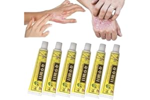 2025 New 6Pcs 𝐍𝐚𝐭𝐮𝐫𝐚𝐥 𝐏𝐬𝐨𝐫𝐢𝐚𝐬𝐢𝐬 𝐂𝐫𝐞𝐚𝐦,𝐈𝐭𝐜𝐡𝐲 𝐒𝐤𝐢𝐧 𝐅𝐚𝐬𝐭 𝐑𝐞_𝐥𝐢𝐞𝐟 𝐂𝐫𝐞𝐚𝐦,𝐂𝐡𝐢𝐧𝐞𝐬