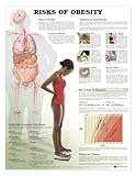Risks of Obesity Anatomical Chart, Anatomical Chart Company Staff, 1587793814
