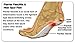 Plantar Fasciitis Therapy Wrap - Original Plantar Fasciitis Heel Cushion Arch Support, Relieve Plantar Fasciitis, Heel, Arch Pain, Plantar Fasciitis Compression Sock - Increase Circulation