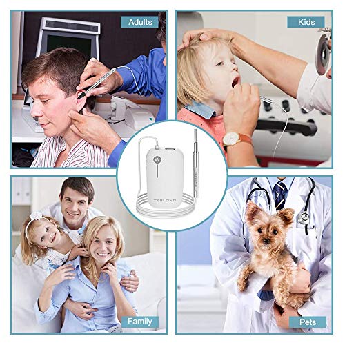 4 Otoscope+Teslong+Microscope+Inspection+Adjustable