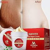 EDTara Scar Removal Cream, Smooth Skin Repair Cream for Stretch Marks Scar Removal Skin Repair Body Cream