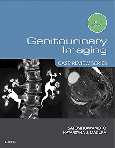 Download Genitourinary Imaging: Case Review Series E-Book (English Edition) PDF