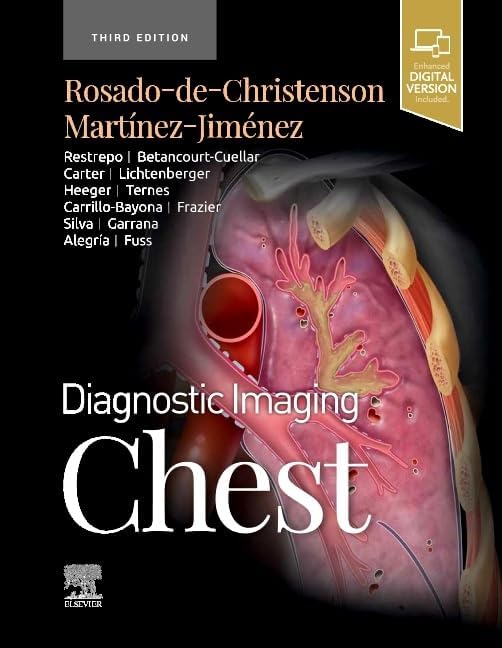 Diagnostic Imaging: Brain: 9780323377546: Medicine & Health