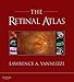 The Retinal Atlas (Expert Consult)