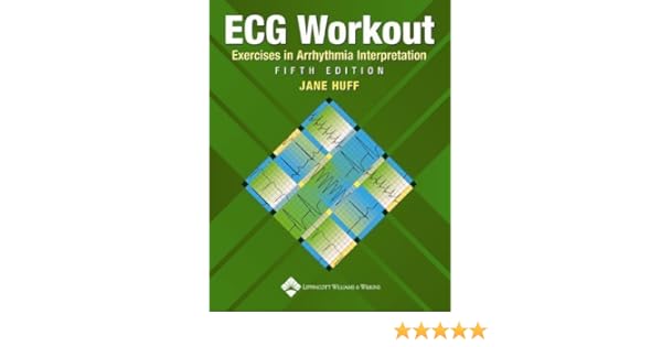 Ecg Workout Exercises In Arrhythmia Interpretation 5th