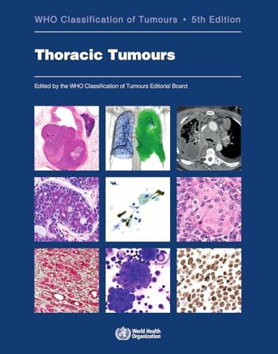 Breast Tumours: WHO Classification of Tumours (Medicine