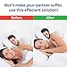 AtoZ Anti snoring Devices - Anti snoring Chin Strap - Snore Stopper Strap - Stop snoring Chin Strap for snoring - Snoring Chin Strap - New Anti Snoring device for Men Women jaw Support