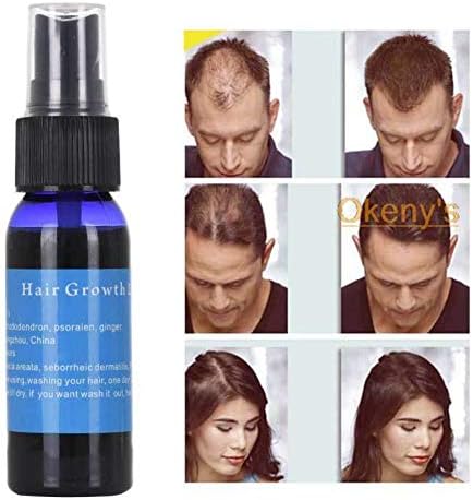 1 piece 30ML Pro Hair Growth Nourishing Essence Hair Liquid Natural Pure Essential Ginger Oils Dense Hair Growth Serum Hair Care TSLM2