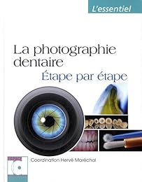 La  photographie dentaire étape par étape