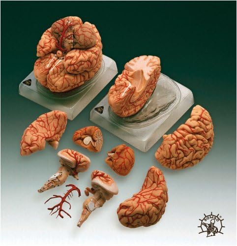 Brain With Arteries Model-BS23