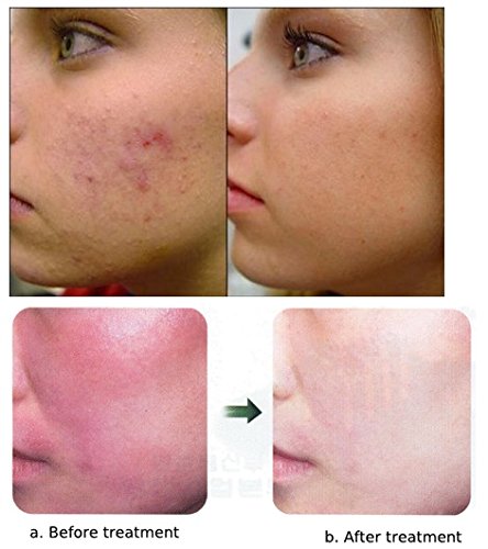 skin prone to redness