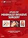 Atlas of Minimally Invasive Surgery with DVD