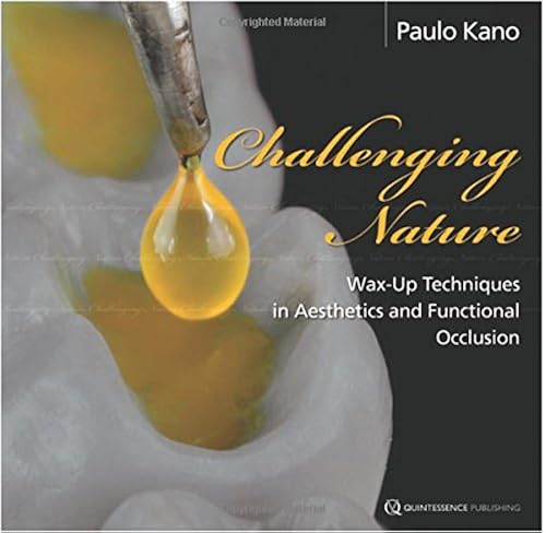 Download Challenging Nature: Wax-up Techniques in Aesthetics and Functional Occlusion PDF