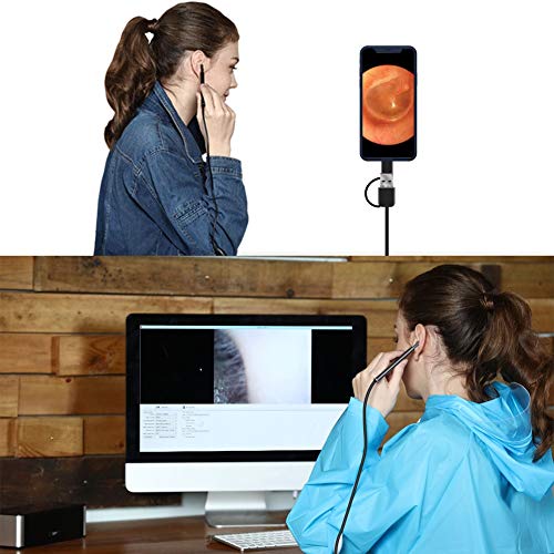 Aisheny 3-in-1 Digital Led Otoscope, Protable Ear Camera Scope Earwax Removal Kit Ear Wax Cleaning Tool Waterproof Rated IP67, USB Micro USB Type-C