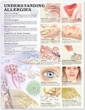 Understanding Allergies Anatomical Chart, Anatomical Chart Company Staff, 1587792990