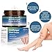 Foot Fungus Cream,Antifungal Foot Cream,Athletes Foot Cream,Foot Repair Cream Anti Itch Moisturizes for Athletes Foot Infections Foot Ringworm Cracked Feetthumb 1