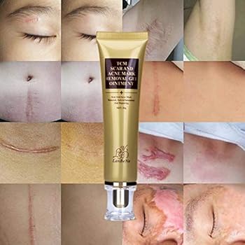whitening cream for scars