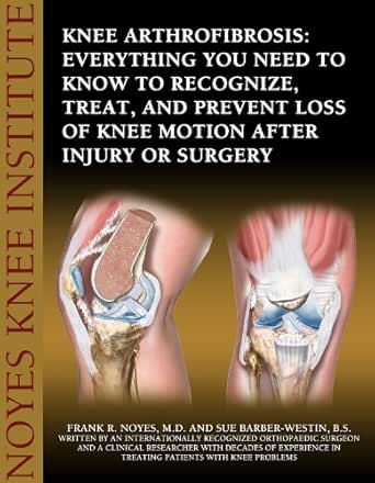 Knee Arthrofibrosis Everything You Need To Know To Recognize Treat And Prevent Loss Of Knee Motion After Injury Or Surgery Kindle Edition By Noyes Frank Barber Westin Sue Professional Technical Kindle