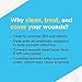 Johnson & Johnson Band-Aid First Aid Gauze Pads, 4 Inch x 4 Inch, 25 Count (Pack of 2)