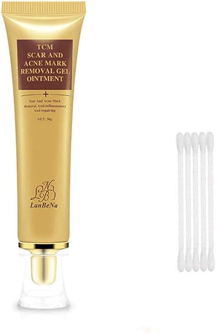 best treatment for acne pigmentation