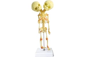 EVOTECH SCIENTIFIC Human Infant Skeleton Model, Twin-Skull, Human Fetus Skeleton W/Double-Skull Model for Display Study Teaching and Gift for Halloween