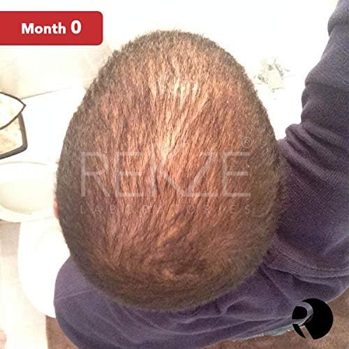 REKZE 63 Hair Growth Shampoo, Clinically Proven w/Caffeine, Biotin, Saw Palmetto, Thickening Therapy For Men & Women - Image 4