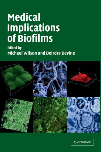 MEDICAL IMPLICATIONS OF BIOFILMS