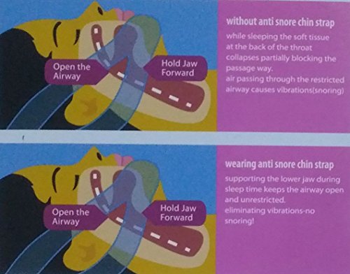 image for 1Olio Adjustable Anti snoring chin strap-Instant Snore Relief - Stop S