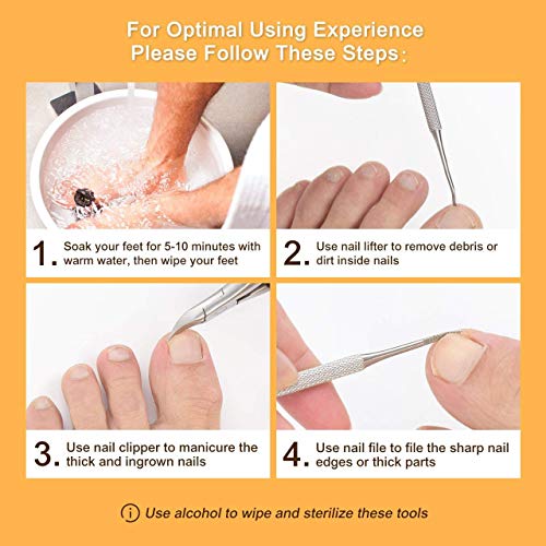 Ingrown Toenail Tool Set Toenail Clippers for Thick Nails, Nail Lifter and Toenail File, sharp and Safe Stainless Steel, 3 PCS Toenail Tools Set for Ingrown Toenail Correction Tool