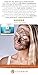 Puriderma Scar Removal Cream Advanced Treatment for Face & Body With Natural Herbal Extracts Formula, B19, 1 Pound