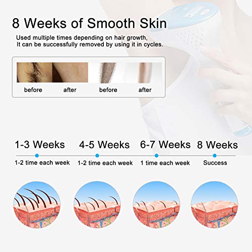 Permanent Laser Hair Removal System for Women & Men,FDA Approved Painless IPL Hair Removal Device 300000 Flashes Professional Light Laser Hair Removal at Home Use,Facial Hair Removal for Women