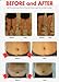 Hot Fat Burner PPC Anti Cellulite S Line Body Slimming Coach Lipo Dissolving Secondary Botox Cream - 200 ml
