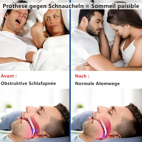 DOHUG Snore Splint, Adjustable Bite Splint Against Snoring and Crunching - Anti Snoring Snoring Stopper - Anti-Snoring Mouth Guard - Improves Sleep Quality (White Medium)